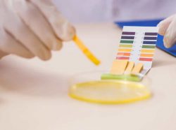 ph-urine